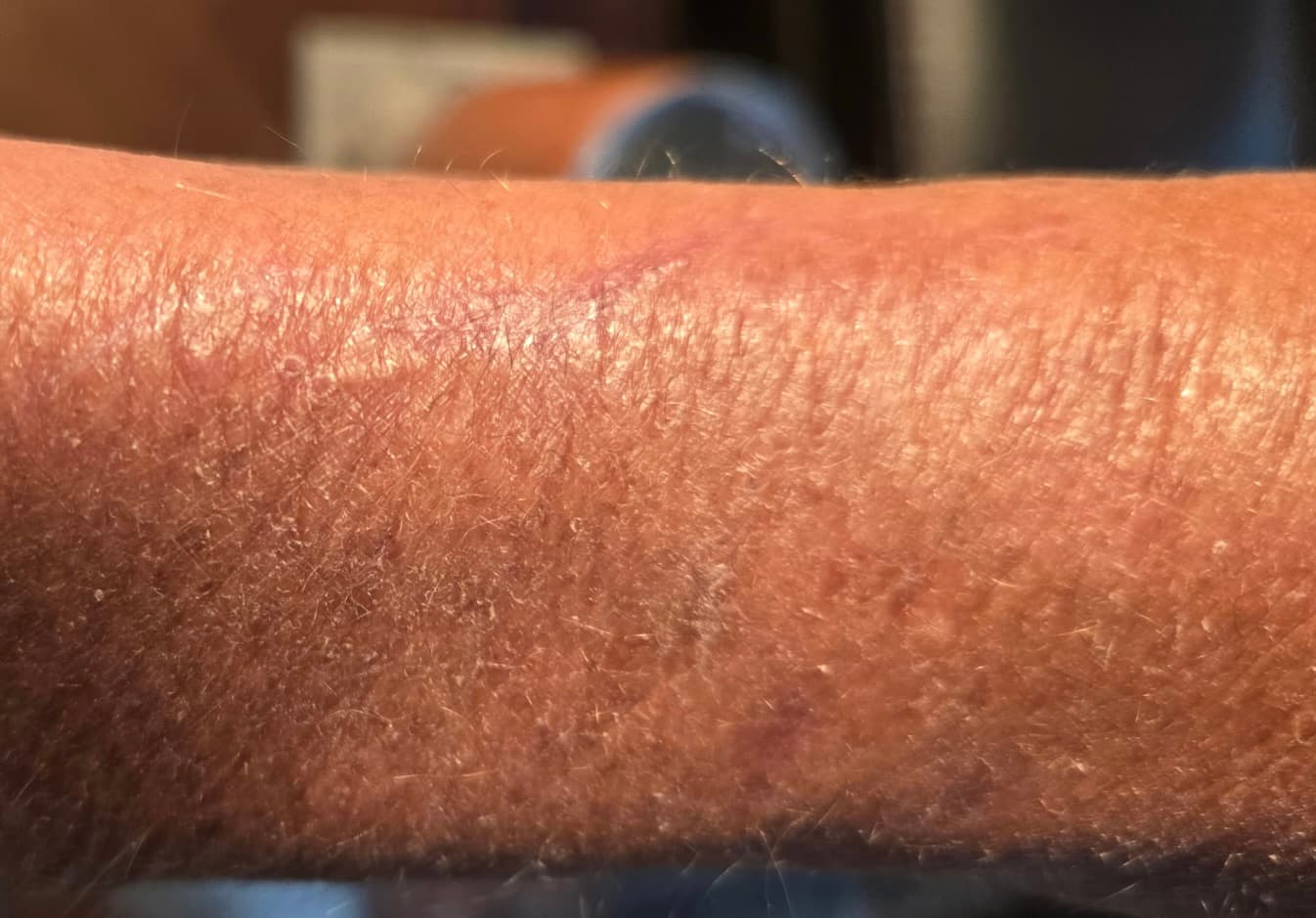 After - Skin Recovery