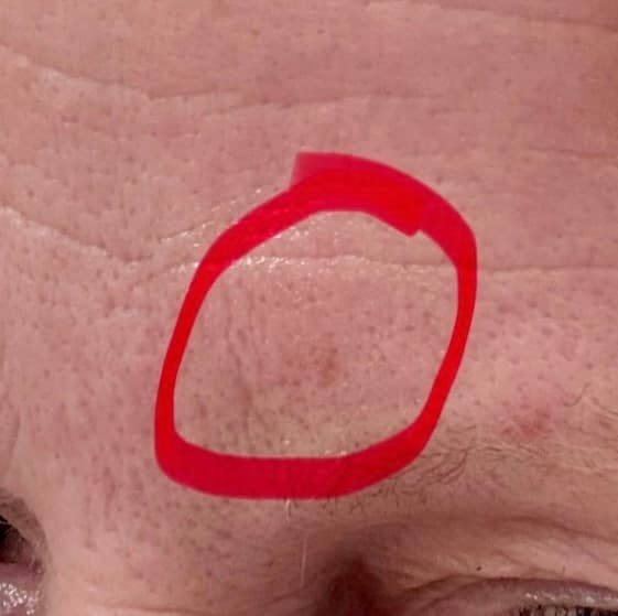 After - Hand Skin Improvement