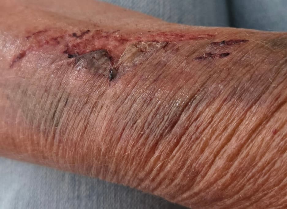 Before - Skin Recovery
