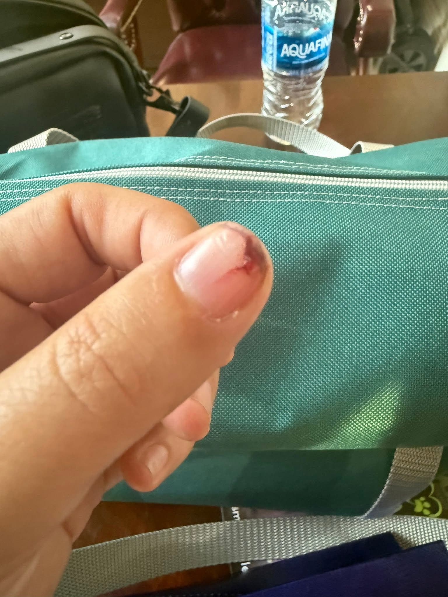 Before - Nail Condition Improvement